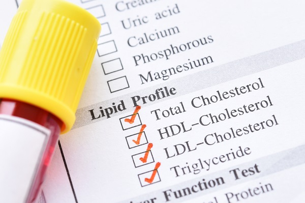 Manfaat Puasa untuk Membantu Mengurangi atau Kurangi Kadar Kolesterol bagi Pengidap Kolesterol Tinggi