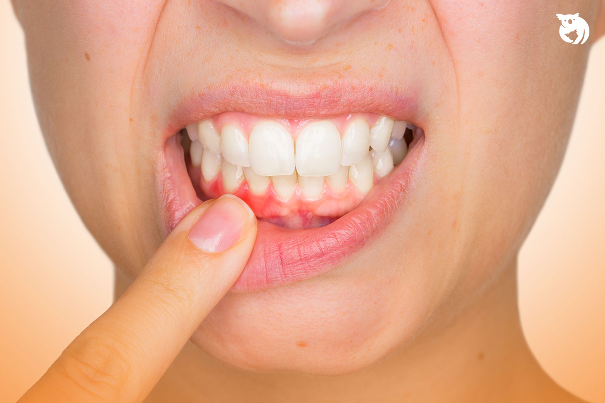 Macam-Macam Penyakit Gigi dan Mulut serta Asuransinya